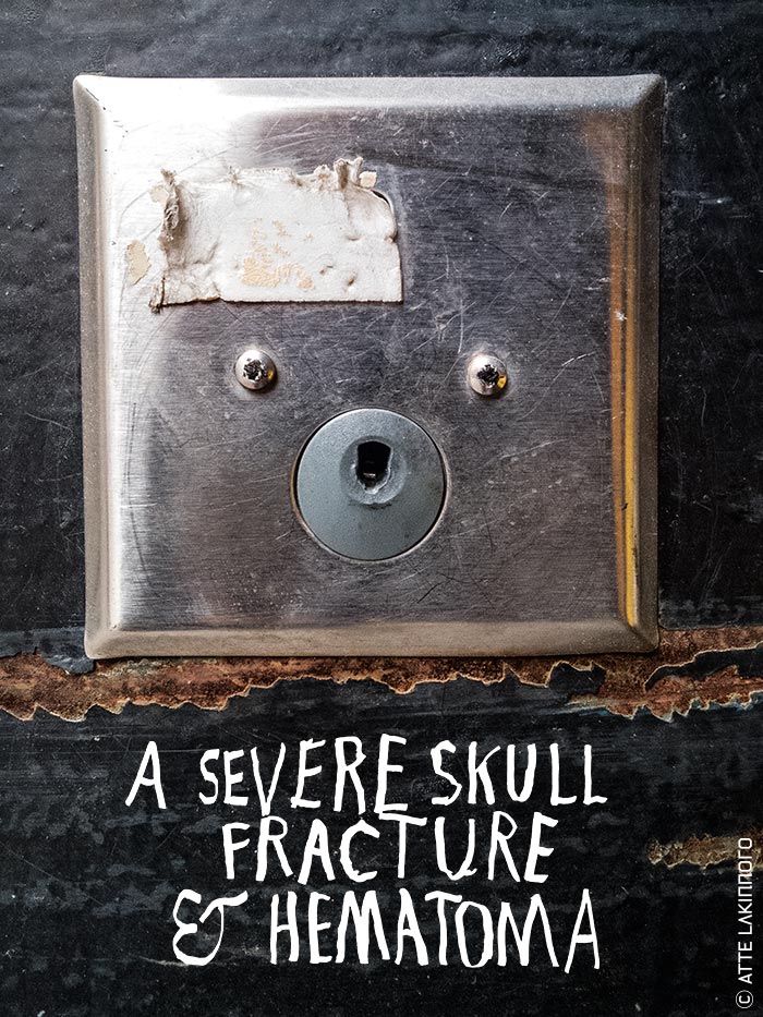 Face0048 lakinnoro.com